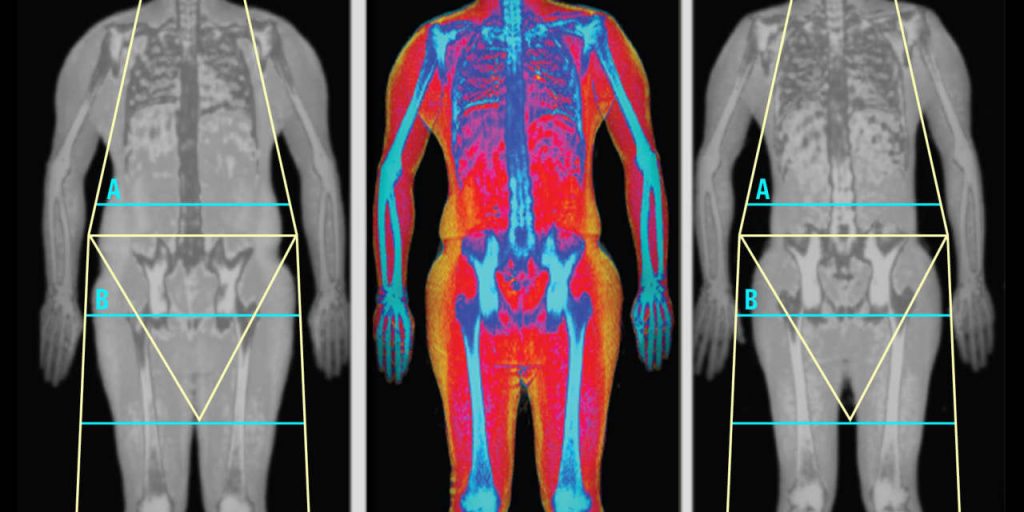 BMI Calculators Don’t Tell You Enough. How to Measure Unhealthy Fat.